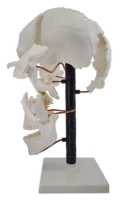 Beauchene Exploded Skull