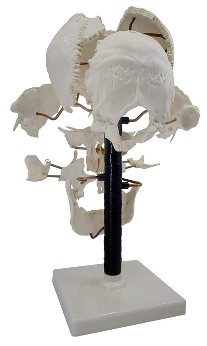 Beauchene Exploded Skull